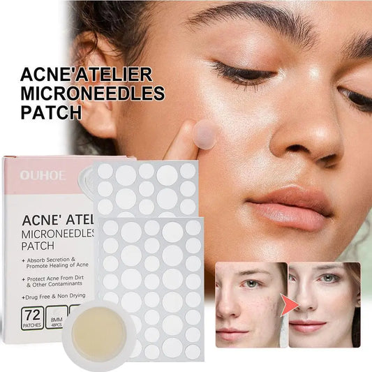 Acne Treatment Concealer