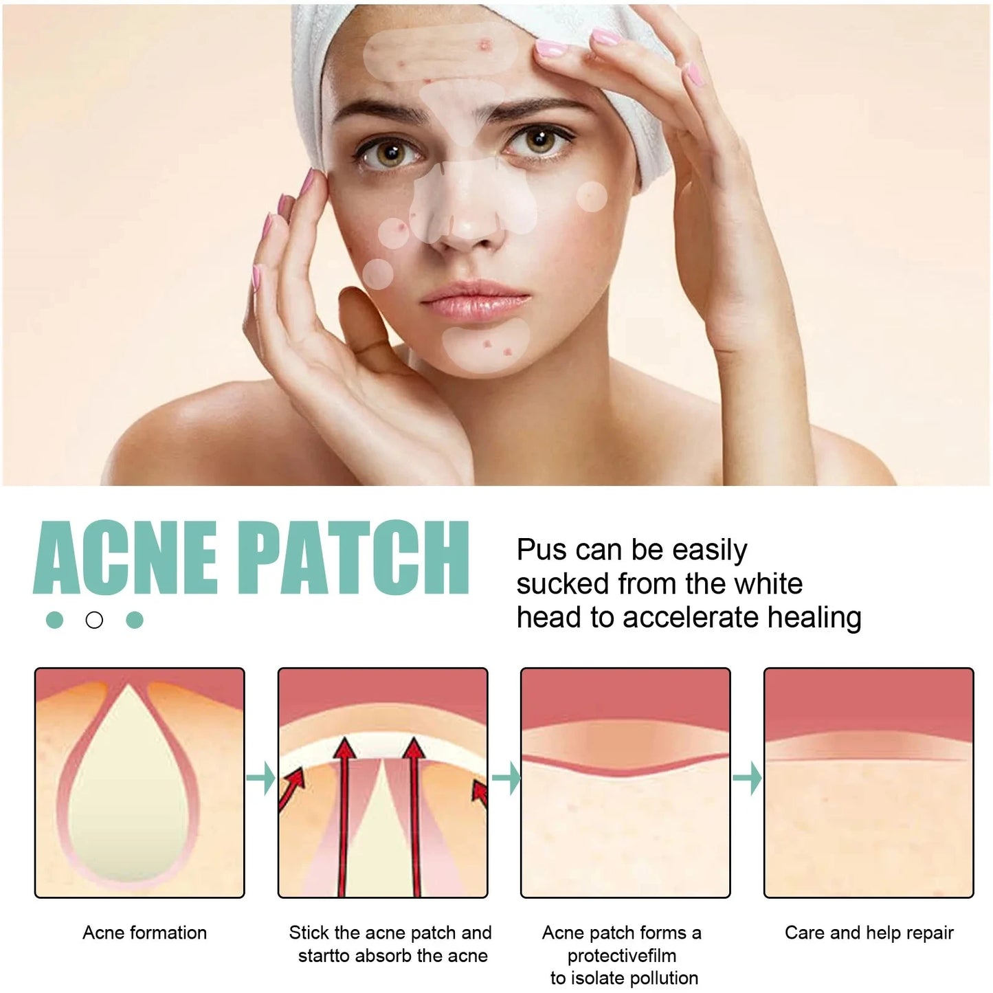 Acne Patch Blackhead Remover