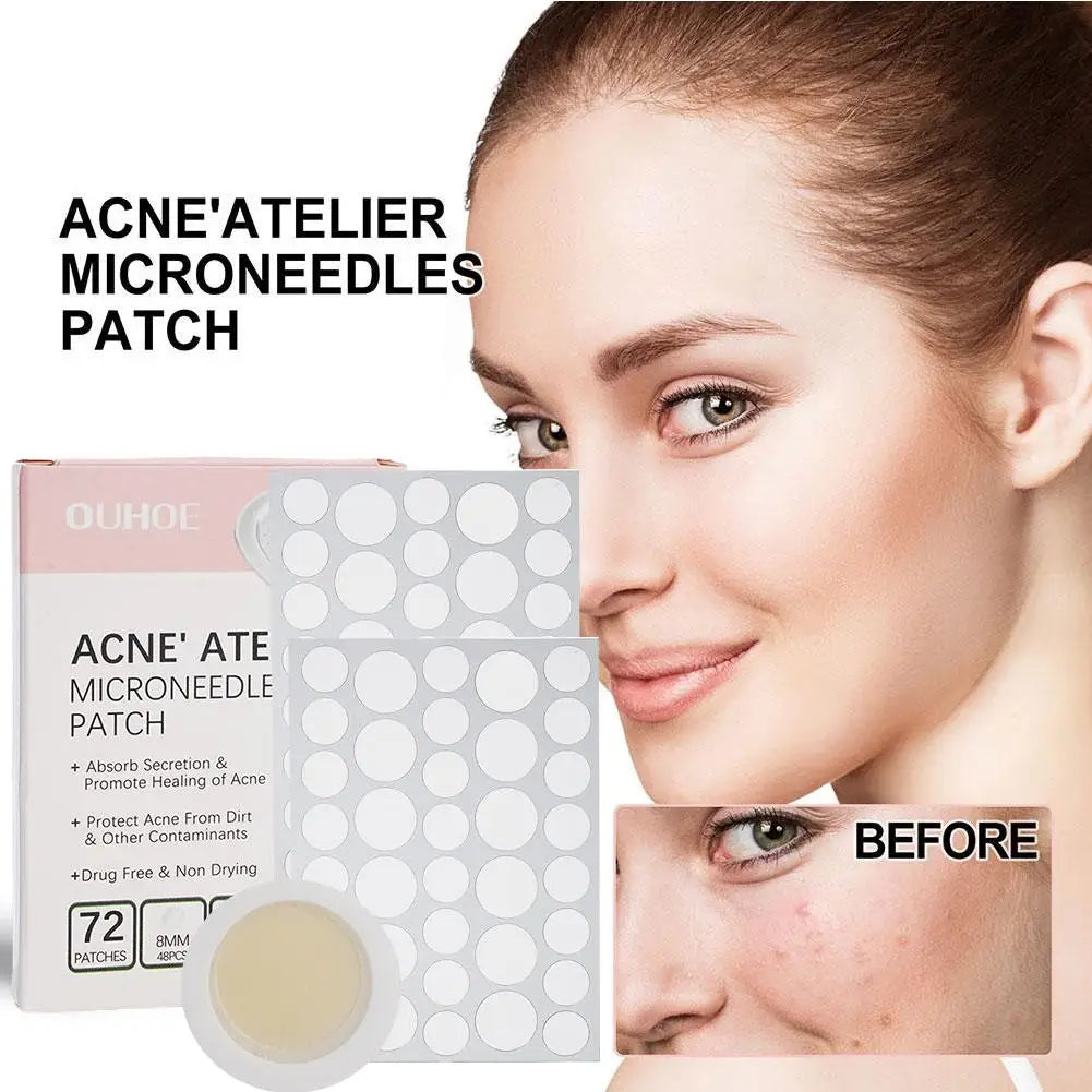 Acne Treatment Concealer