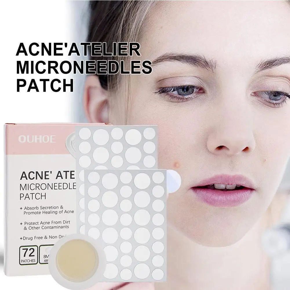 Acne Treatment Concealer